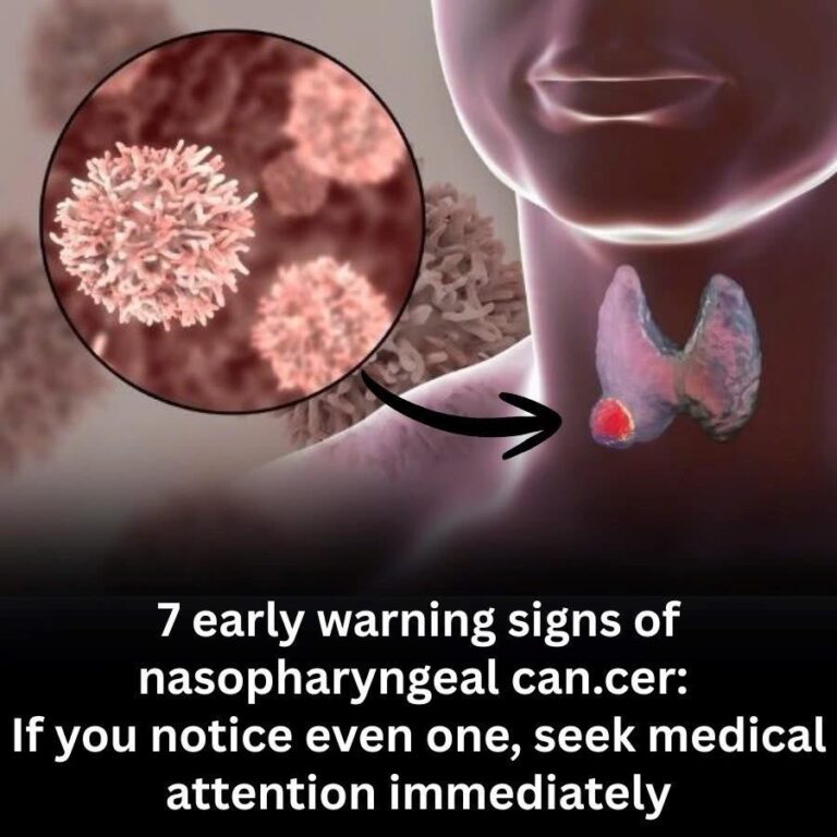 signs of nasopharyngeal