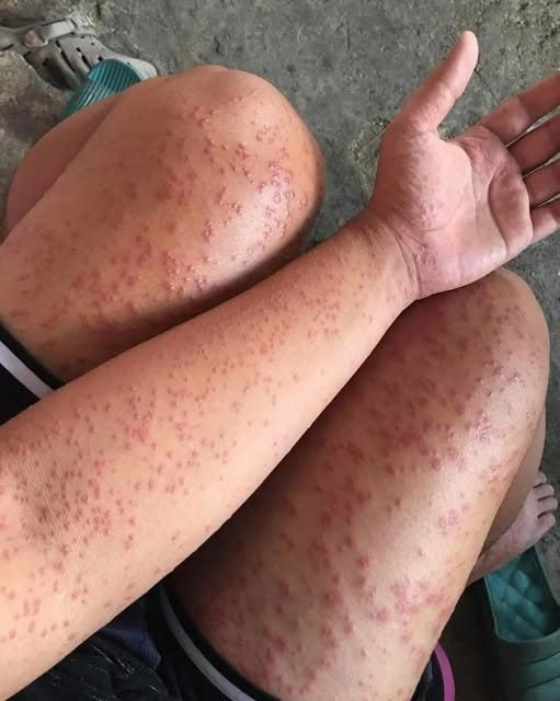 skin-notice skin-notice